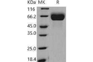 Western Blotting (WB) image for Fibroblast Growth Factor Receptor 1 (FGFR1) protein (His tag) (ABIN7320381)