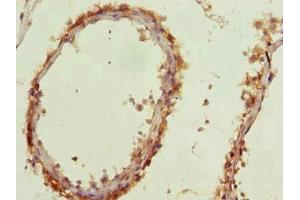 Immunohistochemistry of paraffin-embedded human testis tissue using ABIN7144386 at dilution of 1:100 (AP4B1 抗体  (AA 201-500))