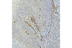 Immunohistochemistry (IHC) image for anti-Nuclear Receptor Subfamily 4, Group A, Member 3 (NR4A3) (AA 1-280) antibody (ABIN6148988)