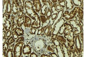 Immunohistochemistry (IHC) image for anti-Melanoma Antigen Family A, 1 (Directs Expression of Antigen MZ2-E) (MAGEA1) (N-Term) antibody (ABIN6263074)