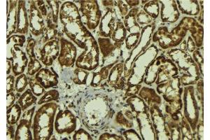 ABIN6278147 at 1/100 staining Mouse kidney tissue by IHC-P. (MAGEA1 抗体  (N-Term))