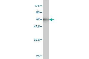 Western Blot detection against Immunogen (56. (CBR1 抗体  (AA 1-277))
