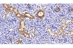Detection of AST2 in Rat Parotid Gland Tissue using Polyclonal Antibody to Aspartate Aminotransferase 2 (AST2) (AST2 (AA 30-430) 抗体)