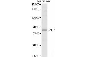 Western blot analysis of extracts of mouse liver, using AFP antibody (ABIN5997204) at 1/1000 dilution. (alpha Fetoprotein 抗体)