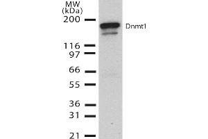 Western Blot analysis of Human H1299 cell lysate showing detection of DNMT1 protein using Mouse Anti-DNMT1 Monoclonal Antibody, Clone 60B1220. (DNMT1 抗体  (AA 637-650) (Atto 390))