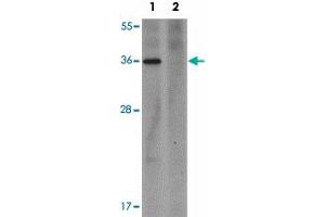 Western blot analysis of PLAC1 in human placenta tissue lysate with PLAC1 polyclonal antibody  at 1 ug/mL in (1) the absence and (2) the presence of blocking peptide. (PLAC1 抗体  (C-Term))