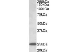 Western Blotting (WB) image for anti-Abhydrolase Domain Containing 14B (ABHD14B) (AA 188-200), (Internal Region) antibody (ABIN1105190) (ABHD14B 抗体  (Internal Region))