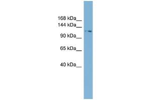 WB Suggested Anti-TTC17  Antibody Titration: 0. (TTC17 抗体  (N-Term))