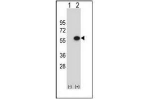 Western blot analysis of ERGIC3 (arrow) using ERGIC3 Antibody (N-term) Cat. (ERGIC3 抗体  (N-Term))