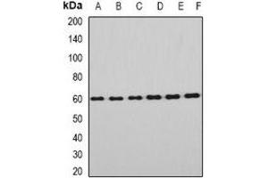 Western blot analysis of EYA3 expression in Hela (A), HT29 (B), mouse eye (C), mouse testis (D), rat brain (E), rat liver (F) whole cell lysates. (EYA3 抗体)