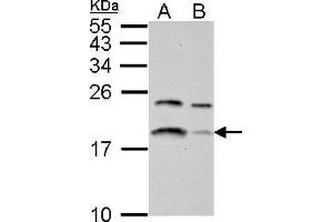 WB Image LC3B antibody detects LC3B protein by western blot analysis. (LC3B 抗体)