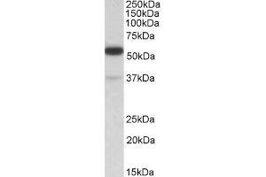 Western Blotting (WB) image for anti-Tripartite Motif Containing 5 (TRIM5) (N-Term) antibody (ABIN184983)