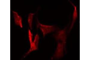 ABIN6278839 staining HuvEc by IF/ICC. (CDH26 抗体  (N-Term))