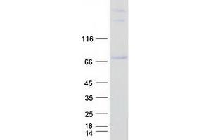 Validation with Western Blot (RUNX1T1 Protein (Transcript Variant 4) (Myc-DYKDDDDK Tag))