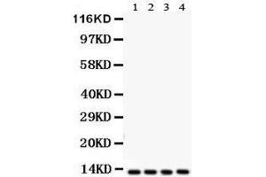 Anti-Cytochrome C antibody, Western blotting All lanes: Anti Cytochrome C  at 0. (Cytochrome C 抗体  (C-Term))