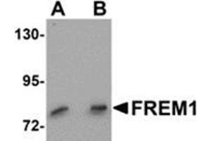 Western blot analysis of FREM1 in K562 cell lysate with FREM1 antibody at (A) 0. (FREM1 抗体  (C-Term))