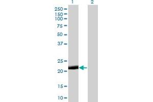 Western Blot analysis of PAGE4 expression in transfected 293T cell line by PAGE4 monoclonal antibody (M01), clone 7C3. (PAGE4 抗体  (AA 1-102))