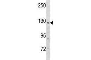 Insulin receptor R antibody western blot analysis in mouse heart tissue lysate (INSRR 抗体  (AA 1228-1255))