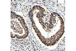 IHC analysis of HNRNPL using anti-HNRNPL antibody (ABIN4886624).
