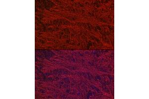 Immunofluorescence (IF) image for anti-Neurofilament, Light Polypeptide (NEFL) antibody (ABIN7268867)