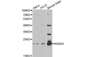 Western blot analysis of extracts of various cell lines, using RAB5A antibody. (RAB5 抗体  (AA 1-215))