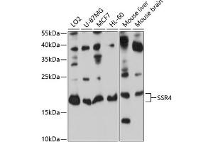 Western blot analysis of extracts of various cell lines, using SSR4 antibody (ABIN6133183, ABIN6148490, ABIN6148491 and ABIN6224060) at 1:1000 dilution. (SSR4 抗体  (AA 24-144))