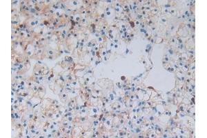 Immunohistochemistry (IHC) image for anti-S100 Calcium Binding Protein A8 (S100A8) (AA 1-93) antibody (ABIN7434062)