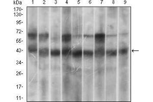 Western blot analysis using MAPK14 mouse mAb against Hela (1), HEK293 (2), A431 (3), MCF-7 (4), RAW264. (MAPK14 抗体  (AA 299-360))