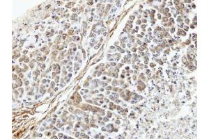 IHC-P Image Immunohistochemical analysis of paraffin-embedded SNU16 xenograft, using TUFM, antibody at 1:100 dilution. (TUFM 抗体)