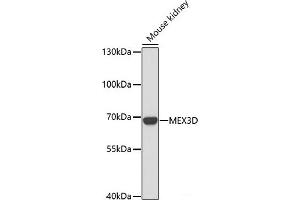 Western blot analysis of extracts of Mouse kidney using MEX3D Polyclonal Antibody at dilution of 1:1000. (MEX3D 抗体)