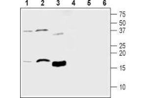 Western blot analysis of mouse brain lysate (lanes 1 and 4), rat brain lysate (lanes 2 and 5) and human recombinant MANF protein (lanes 3 and 6): - 1-3. (MANF 抗体  (Mature))
