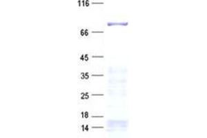 Western Blotting (WB) image for rho GTPase Activating Protein 24 (ARHGAP24) protein (His tag) (ABIN5505760)
