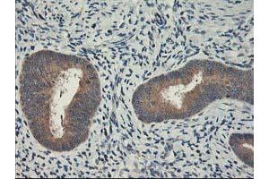 Immunohistochemical staining of paraffin-embedded Human endometrium tissue using anti-CXorf26 mouse monoclonal antibody. (CXorf26 抗体)
