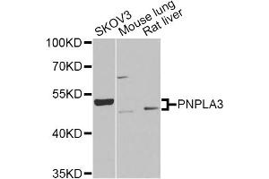 Western blot analysis of extracts of various cell lines, using PNPLA3 Antibody (ABIN2564605) at 1:1000 dilution. (PNPLA3 抗体)