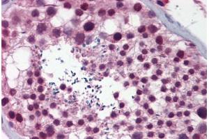 Human Testis: Formalin-Fixed, Paraffin-Embedded (FFPE) (NASP 抗体  (AA 287-336))