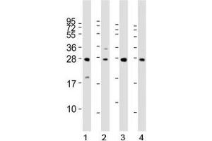 Western blot analysis of LIN28B antibody and 1) HeLa, 2) K562, 3) mouse testis and 4) NCCIT lysate. (LIN28B 抗体  (AA 95-128))