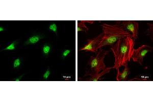 ICC/IF Image CDK4 antibody detects CDK4 protein at nucleus by immunofluorescent analysis.