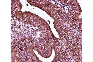 Immunohistochemistry (IHC) image for anti-Estrogen Receptor 1 (ESR1) (AA 246-273) antibody (ABIN3030871)