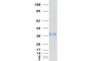 Validation with Western Blot