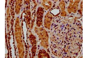 IHC image of ABIN7174060 diluted at 1:200 and staining in paraffin-embedded human kidney tissue performed on a Leica BondTM system. (RYK 抗体  (AA 494-586))