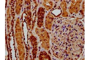 IHC image of ABIN7174060 diluted at 1:200 and staining in paraffin-embedded human kidney tissue performed on a Leica BondTM system. (RYK 抗体  (AA 494-586))
