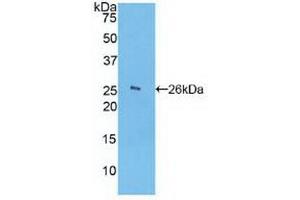 Detection of Recombinant FCN1, Human using Polyclonal Antibody to Ficolin 1 (FCN1) (FCN1 抗体  (AA 45-249))
