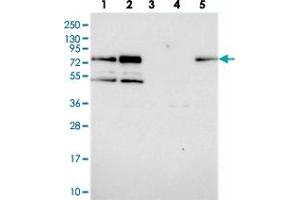 Western blot analysis of Lane 1: RT-4, Lane 2: U-251 MG, Lane 3: Human Plasma, Lane 4: Liver, Lane 5: Tonsil with APBA3 polyclonal antibody  at 1:250-1:500 dilution.