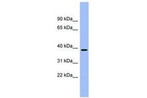 Image no. 1 for anti-Aminocarboxymuconate Semialdehyde Decarboxylase (ACMSD) (AA 251-300) antibody (ABIN6743386) (ACMSD 抗体  (AA 251-300))