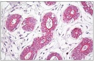 Immunohistochemistry (Paraffin-embedded Sections) (IHC (p)) image for anti-Endothelin Receptor Type A (EDNRA) (C-Term) antibody (ABIN1449644)