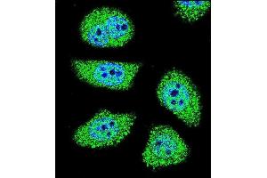 Confocal immunofluorescent analysis of K6 Antibody (Center) (ABIN656098 and ABIN2845441) with U-251MG cell followed by Alexa Fluor 488-conjugated goat anti-rabbit lgG (green). (PAK6 抗体  (AA 268-297))