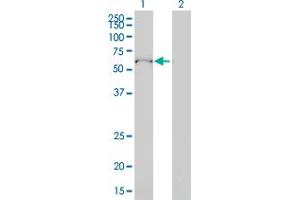 Western Blot analysis of ULK4 expression in transfected 293T cell line by ULK4 monoclonal antibody (M01), clone 4A10-1A7. (ULK4 抗体  (AA 1-580))