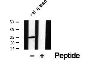 Western blot analysis of extracts from Rat spleen lysate, using CACNG1 antibody. (CACNG1 抗体  (Internal Region))