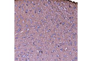 IHC analysis of NEAS/SPTAN1 using anti-NEAS/SPTAN1 antibody (ABIN7600436).