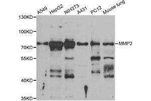Western Blotting (WB) image for anti-Matrix Metalloproteinase 2 (MMP2) antibody (ABIN1882374) (MMP2 抗体)